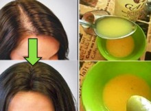 leave-all-doctors-surprised-apply-this-remedy-and-your-hair-will-grow-faster-than-ever
