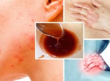 you-need-to-flush-toxins-out-of-your-body-if-you-see-these-warning-signs