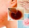 you-need-to-flush-toxins-out-of-your-body-if-you-see-these-warning-signs