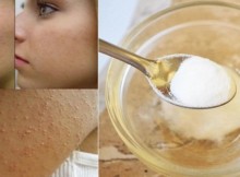 Apply This Mixture on Your Face and Your Skin Will Be Smoother than Ever