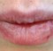 Do You Often Have Dry Lips Attention, It is Important to Know This