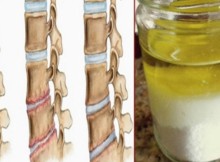 The Combination of Salt and Olive Oil Can Alleviate Many Pains in the Body