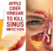 You have a sinus infection Treat it instantly, you have this in your kitchen!