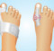 Bunions can be removed entirely Naturally!