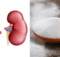 Improve the Health of Your Kidneys on a Natural Way, Using Just One Special Ingredient
