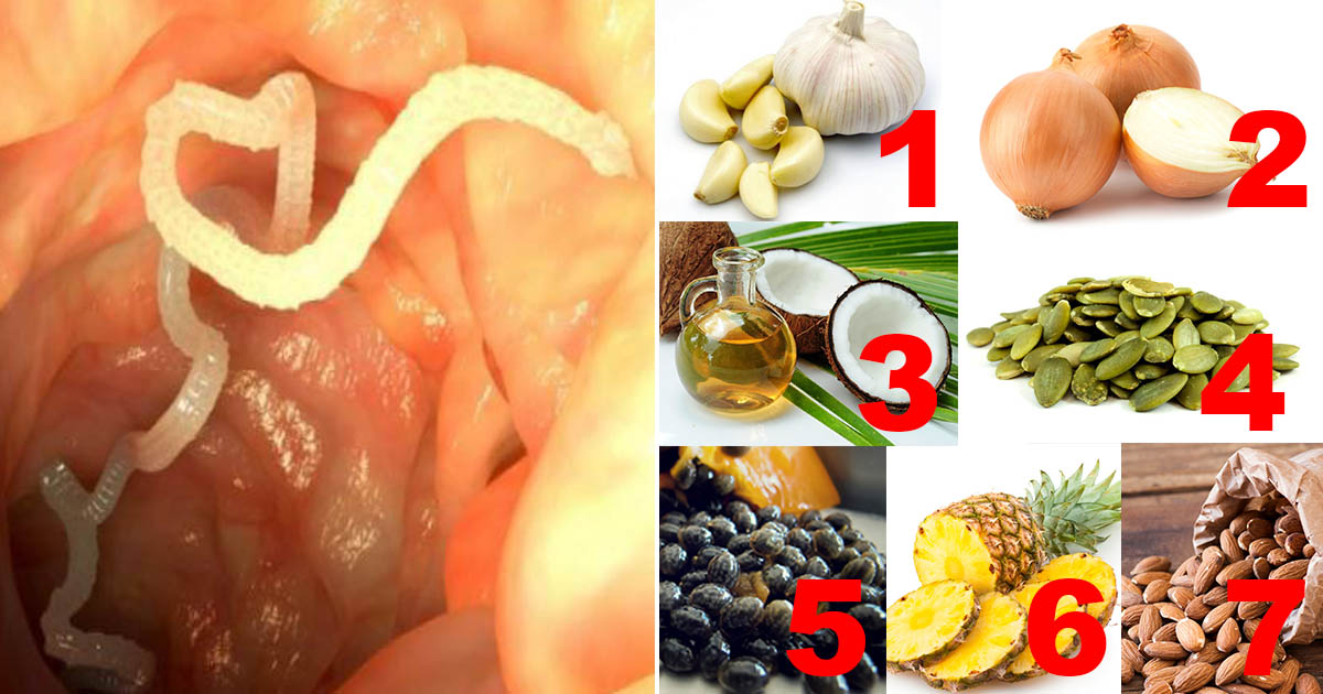 Internal Parasites Can Be Killed By Help of Those 7 Herbs, Fruits, and