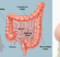 This Magical Beverage Will Help You Clean Your Colon and Burn Fat In The Belly