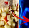 Toxic Waste Could Be Flushed Away Your Colon By Using This Helpful Apple-Honey Mixture