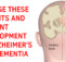 Change these 9 habits and prevent development of Alzheimer’s and Dementia