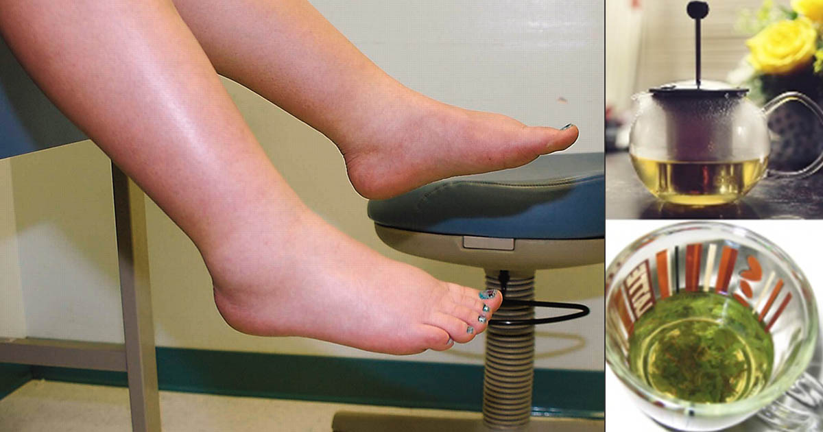 Preparing Parsley Tea for Healing Swollen Ankles, Legs and Feet