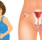 These are the 4 symptoms that you need to be able to recognize in regards to ovarian cancer