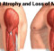 These two fruits will help you prevent atrophy and loss of muscles