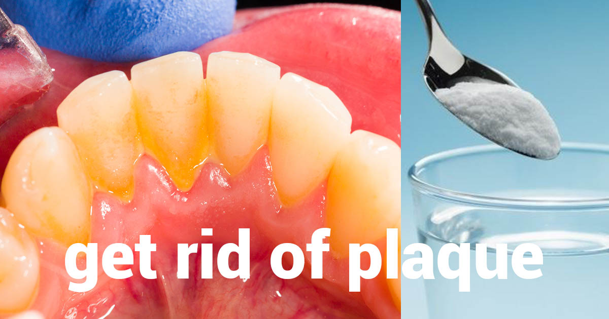 This natural remedy can help you get rid of plaque in 1 minute