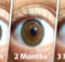 Use this natural remedy to improve your vision and prevent cataract – it is 100% natural