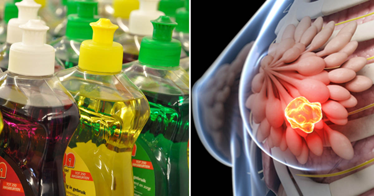 Is Dish Soap Toxic If Swallowed at Elizabeth Anderson blog