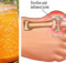 Cure Gout Forever By Using This Natural Treatment