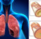 How to Get Rid of Phlegm and Mucus in Chest & Throat (Instant Result)