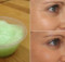 Prepare This Mixture Right Now And Your Wrinkles, Blemishes, Stretch Marks And Burns Will Magically Disappear!