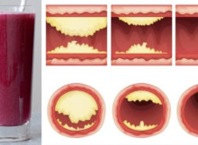 This Juice Unclogs Arteries & Protects Against Heart Disease!