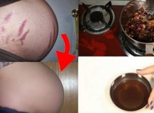 3 Days Challenge – This Miracle Oil Can Remove All Spots and Scars from Your Skin
