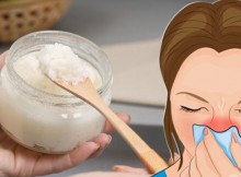 How to destroy the fungus causing your sinus pain, congestion, and headaches