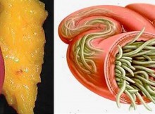 Just Use These 2 Ingredients to Empty All Deposits of Fat And Parasites Of Your Body