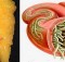 Just Use These 2 Ingredients to Empty All Deposits of Fat And Parasites Of Your Body