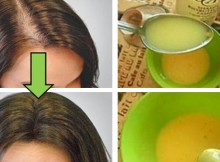 Leave All Doctors Surprised Apply This Remedy and Your Hair Will Grow Faster Than Ever