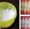 Make Your Teeth White At Home After Only 3 Minutes. A 100% Proof Of Efficacy