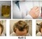 Do You Want To Regain Your Hair Discover This Unique Method to Regenerate Hair!