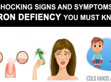Signs and Symptoms of Iron Deficiency You Should Not Ignore