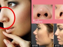 The Only Secret Method for Reshaping Your Nose Naturally