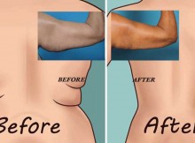 Try The 6 World’s Easiest Exercises for Back Fat and Underarm Flab