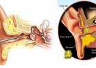 Causes for Ear Wax Buildup and How to Remove It At Home